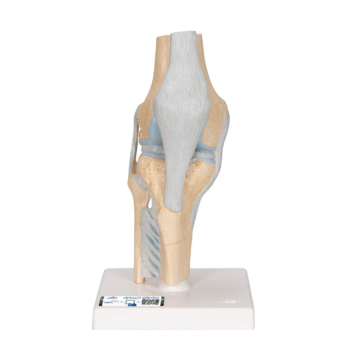 3B Scientific A89 Sectional Knee Joint Model, 3 Part + free anatomy software - 3B Smart Anatomy