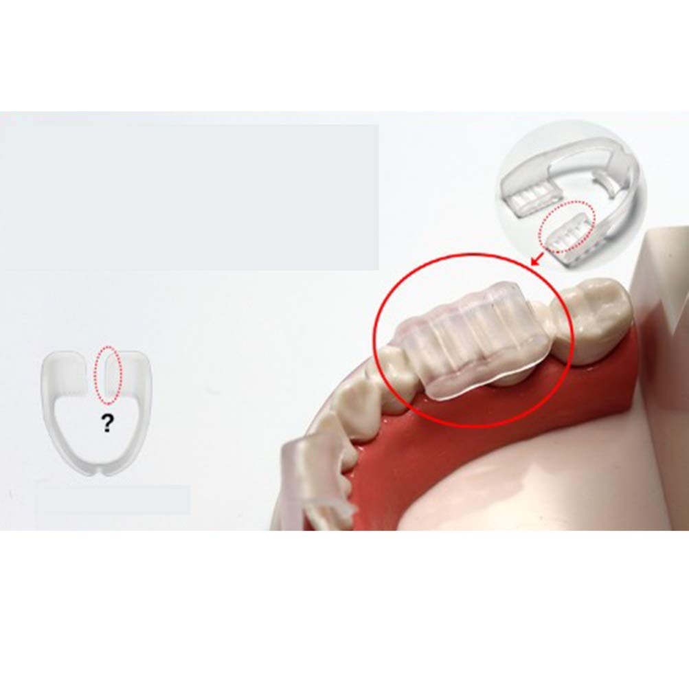 Garneck Dental Guard Sleeping Teeth Mouth Guard to Prevent Teeth Grinding Dental Protector 3pcs (Transparent) : Beauty