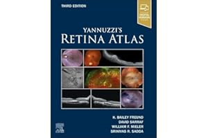 Yannuzzi's Retina Atlas