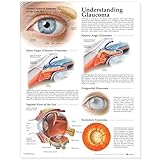 Understanding Glaucoma Anatomical Chart