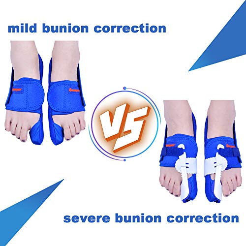 Bunion Corrector [Pair] - Improved Bunion Splint Big Toe Straightener Separators for Hallux Valgus Pain Relief Fits Men & Women - Thumbnail 4