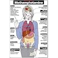 Harmful Effects of Methamphetamine 24" X 36" Laminated Poster