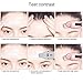 [Clearance sale] SUNMAY Sonic Eye Massager, 42℃ Heated Anion Import Wand for Dark Circles and Puffiness, Skin Care Device (White)