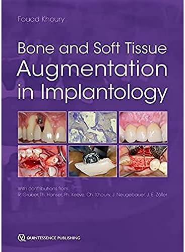 Vertical 2: The Next Leval of Hard and Soft Tissue Augmentation