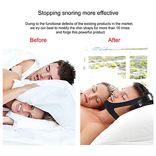 1DOT2 Stop Snoring Chin Strap Adjustabal & Comfortable Odorless anti