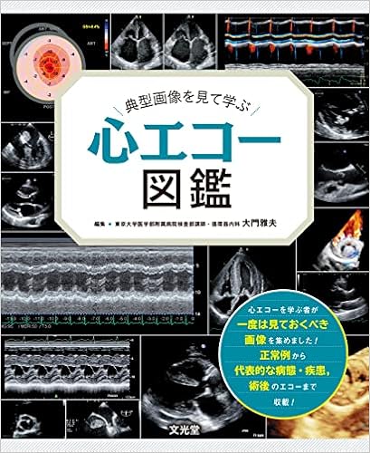 典型画像を見て学ぶ 心エコー図鑑 大門雅夫 本 通販 Amazon