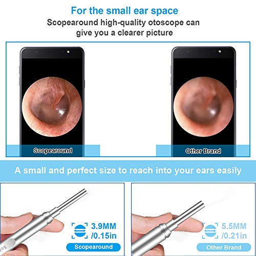 2 Otoscope+Scopearound+Diameter+Ultra+Slim+Adjustable