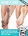 Moisturizing Socks and Pumice Stone for Cracked Feet - 2 x Aloe Socks to Treat Dry Feet Fast + Bonus: Pumice Stone as Heel Scrapper for Feet by Klondermann Spa
