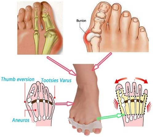 Elastic Gel Toe Separators, Bunion Pain Relief Toe Straightener, Toe Spacers Rubber Toe Stretchers Used for Sports Activities Yoga Practice Running for Women Men (1-pairs)