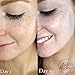 Faith & Grace Aesthetics Anti-Aging Retinol Night Cream With Amazing Anti Wrinkle & Moisturizing Properties - Advanced Formula With Encapsulated Retinol Serum For Uneven Skin Tone And Acne Scars