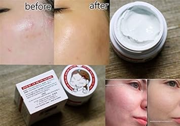 ciracle red spot cream