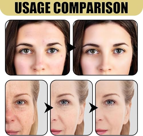KOWVOWZ All in One Cream, Repair Cream, Daily Face Mucin Slime Wrinkles Remove Face for Women and Men Dry and Sensitive Skin Skincare(100 g/3.52oz)