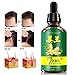 Ginger Germinal Oil, Hair Growth Oil, 2019 Hair Growth Ginger Essential Oil, Ginger Germinal Essential Oil，Hair Loss Treatment Hair Care Hair Growth Serum for Men & Women 30mlthumb 4