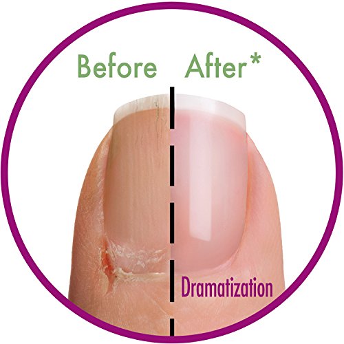 5 Minute Mani: Healing Nail & Cuticle Mask - Thumbnail 5