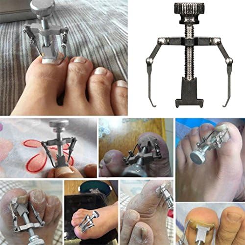 Ec Ingrown Toe Nail Recover Correction Tool Pedicure Toenail Fixer Foot Nail Care