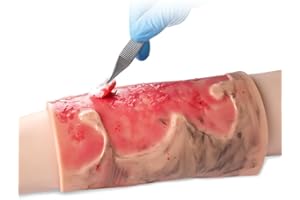 Simulated Burn Wound Model, 2-3 Degree Limb Burns Training Module, Wearable Wound Skin Model, for Burn Care Training, Medical