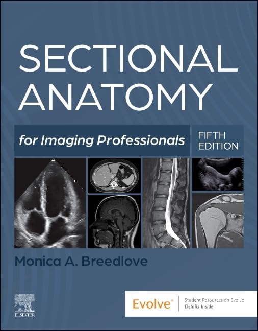 健康・医学 Imaging of the Chest Volume II Muller's Imaging of the Chest: Expert Radiology Series