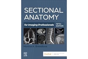 Sectional Anatomy for Imaging Professionals