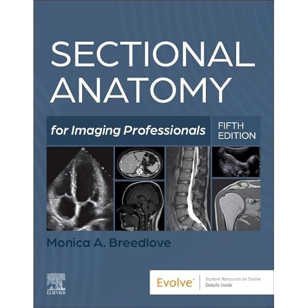 Sectional Anatomy by MRI and CT: 9780323934480: Medicine & Health