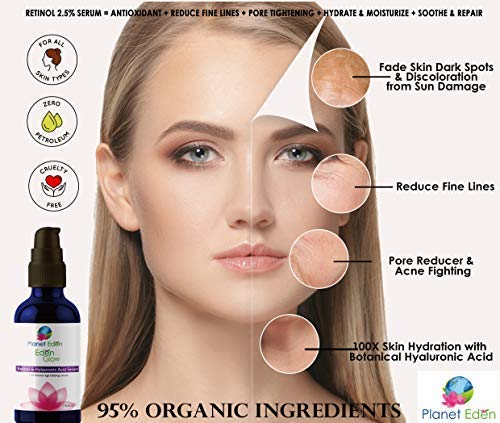 Planet Eden 88% Lactic Acid Skin Chemical Peel Kit with Hyaluronic Acid and 2.5% Retinol Serum and Fan Brush - Professional Grade - Lighten Dark Spots, Tighten Skin, Fade Wrinkles/Fine Lines
