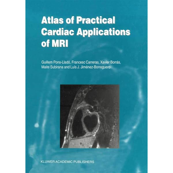 Amazon.com: Atlas of Cardiovascular Computed Tomography
