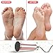 Aunote Electric Callus Remover, Professoinal Pedicure Tools Foot File Speed Adjustable, Most Powerful Replacement Sanding Disk Best Tool Kit For Women/Men Remove Dead, Cracked Skin, Hard,Thick Callus