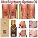 Ultra Brightening Spotless Oil,Uccdo Skin Care Natural Pure Remove Ance,Pure Nature Essential Oil (1Pcs)