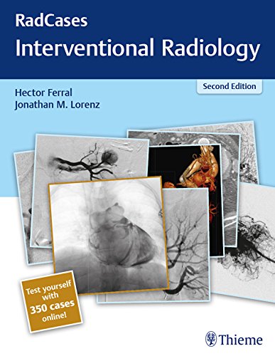D.O.W.N.L.O.A.D Radcases Interventional Radiology (Radcases Plus Q&A) T.X.T