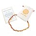 Amber Teething Necklace – Teething Necklace For Babies Unisex – Anti-inflammatory, Swollen gums & Teething Pain Reduce Properties – Certificated Natural Ukrainian Amber Beads