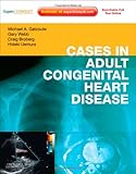 Cases in Adult Congenital Heart Disease - Expert Consult:Online and Print:Atlas, 1e Cases in Adult Congenital Heart Disease - Expert Consult:Online and Print:Atlas, 1e