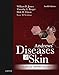 Andrews' Diseases of the Skin E-Book: Clinical Dermatology