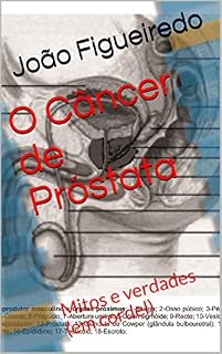 Livro O Câncer de Próstata: Mitos e verdades (em cordel)