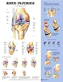 Knee Injuries, Anatomical Chart Company Staff, 1587797577