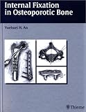 Internal Fixation in Osteoporotic Bone, , 1588900878