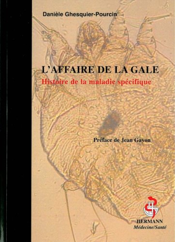 L' affaire de la gale