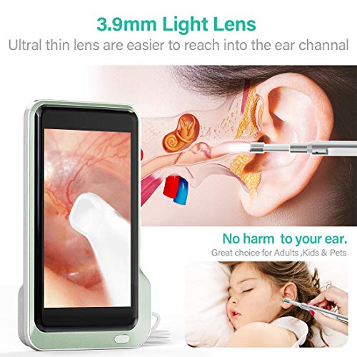 Ear Wax Removal Otoscope,Sinohrd Ear Camera with 5 Inch 1080P HD Screen Ear Scope Otoscopes,3