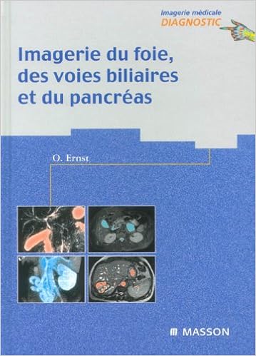 Imagerie Du Foie Des Voies Biliaires Et Du Pancreas Et Du Pancreas Ernst Olivier Amazon Com Books