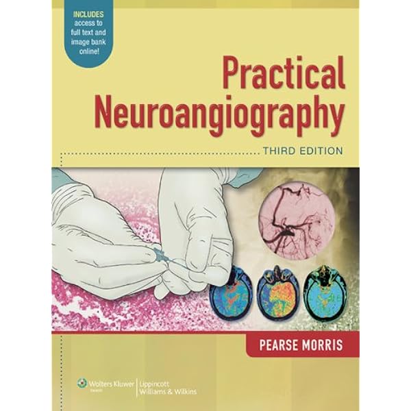 Decision Making in Neurovascular Disease - Kindle edition by