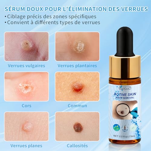Action Removal of Skin Tags – Precision Face & Body Pipette | Targeted Removal of Plantar, Vulgar and Flat Warts | Soft Formula, Travel Size (15 ml)