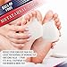 Metatarsal Ball of Foot Cushions – Gel Metatarsal Foot Pads for Women or Men’s Metatarsalgia Pain Relief. Orthotics Metarsal Support Pad with Toe Loop to Help Sesamoiditis & Mortons Neuroma (5 Pairs)thumb 1