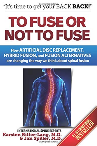 To Fuse or Not to Fuse: How Artificial Disc Replacement, Hybrid Fusion, and Fusion Alternatives are Changing the Way We Think about Spinal Fusion