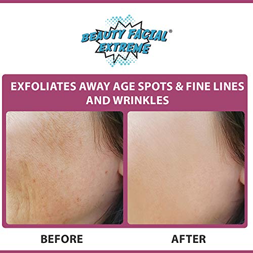 Exfoliating Cleanser Scrub for Face & Body–Exfoliates Dry, Rough Skin. Dark Spot Corrector for Sun Spots & Age Spots. Reduces Wrinkles & Acne Scars. Pore Minimizer & Blackhead Remover for Men & Women. - Thumbnail 4