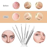 Blackhead Remover, Chimocee 6PCS Pimple Comedone Extractor Tool, Blackhead Whitehead Blemish and Splinter Best Acne Zit Removal Tool for Risk Free Nose Face, A Gift Box with Mirror