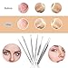CHIMOCEE 6PCS Blackhead Removal Tool Kit for Whitehead, Blemish, Blackhead Remover, Pore Extractor, Acne Tool for Risk Free Nose Face with Dermatologist Grade Surgical Steel, A Gift Box with Mirror