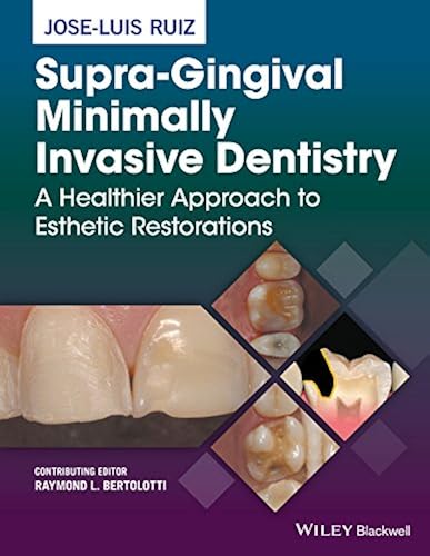 Download Supra-Gingival Minimally Invasive Dentistry: A Healthier Approach to Esthetic Restorations PDF