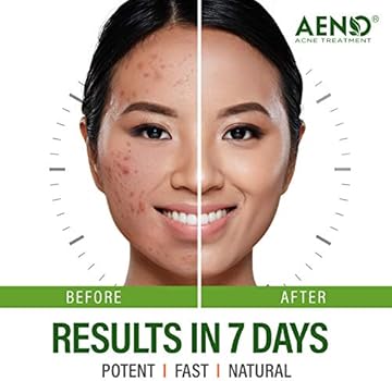 aeno acne treatment
