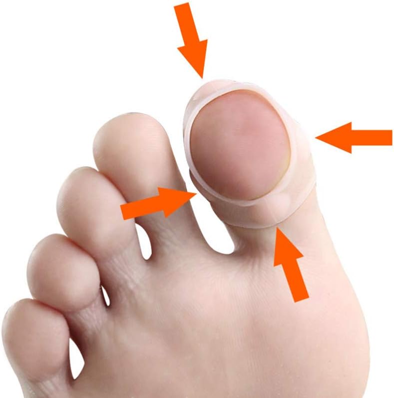 HEALLILY Ingrown Toenail Tool Paronychia Toenail Treatment Tape Toenail Correction Sticker Paronychia Recover Foot Care Tool 3 Pairs - Image 5