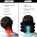 Neck Traction Device + Safety Detachable Connection, No1 Doctors Recommended VITA Activate Cervical Neck Stretcher Corrects Posture, Helps Neck Pain
