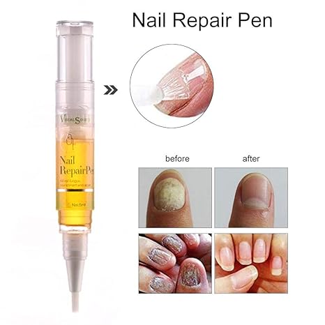 Amazon Co Jp Per Pet 爪真菌治療ペンシル ハーブ系抗真菌剤 Amazon Co Jp Per Pet 爪真菌治療ペンシル ハーブ系抗真菌剤
