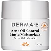 DERMA E Acne Oil Control Face Moisturizer, 2 Oz, Matte Moisturizer with Salicylic Acid, Tea Tree Oil & Aloe Vera, Face Cream Rebalances Sebum Production & Prevents Blemishes, Redness & Breakouts 2 Oz